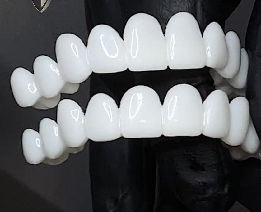 Dental Tooth Prosthesis