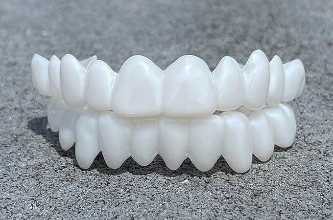 Dental Tooth Prosthesis