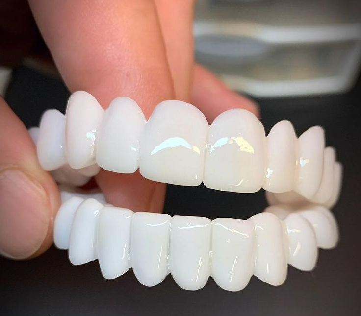 Dental Tooth Prosthesis